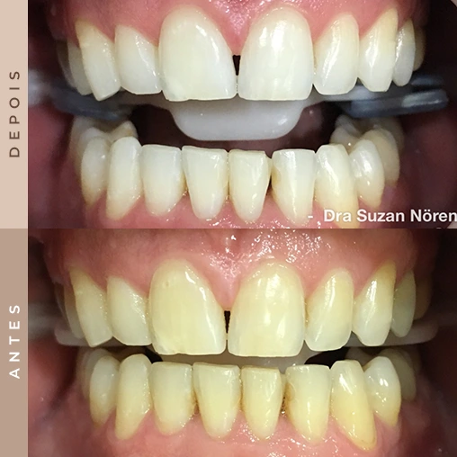 dentista em xanxerê 1