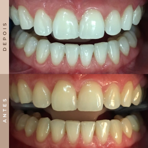 dentista em xanxerê 2