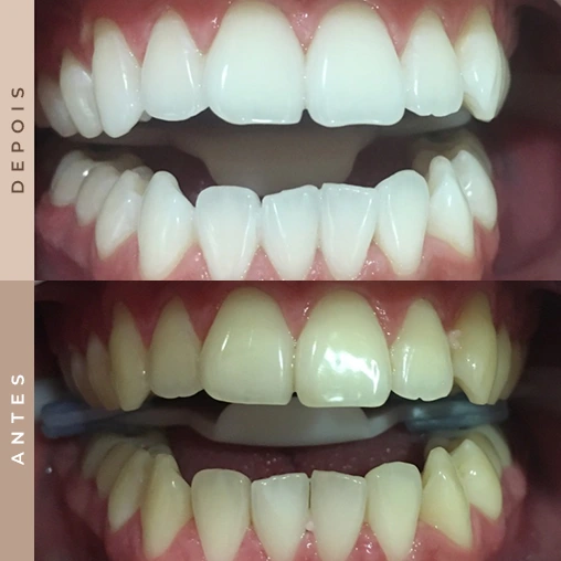 dentista em xanxerê 3