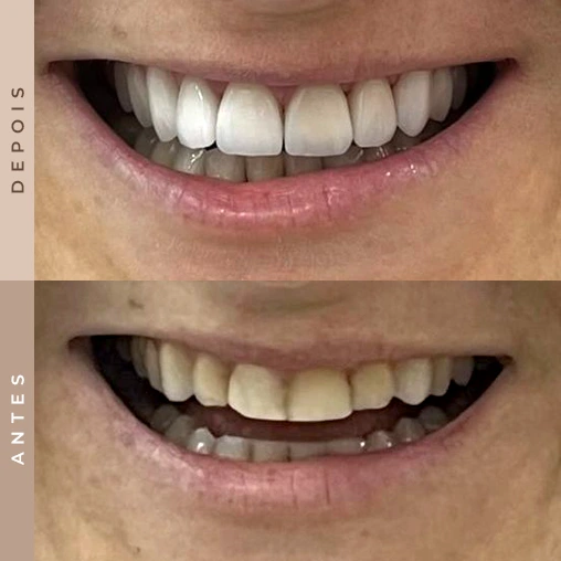 dentista em xanxerê 4
