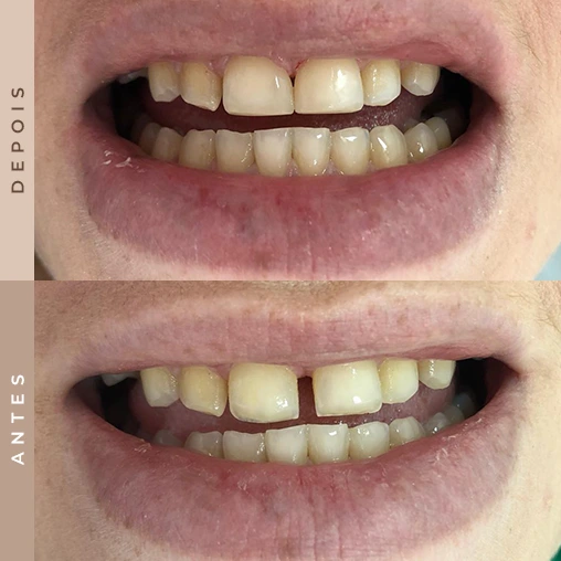 dentista em xanxerê 5