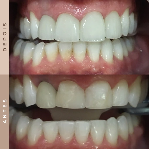 dentista em xanxerê 6
